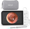 Digital Otoscope with 5 Inch IPS Screen U935798