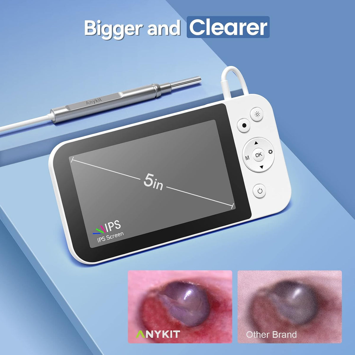 Digital Otoscope with 5 Inch IPS Screen U935798
